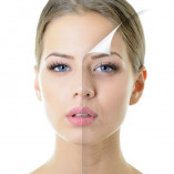 Химические пилинги//home-categories/him-pilingi-20-157x157.jpg